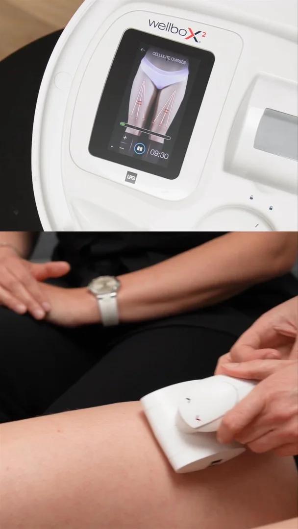 Wellbox® : 72 ventes en un live, le pari gagnant du live shopping beauté-tech 8