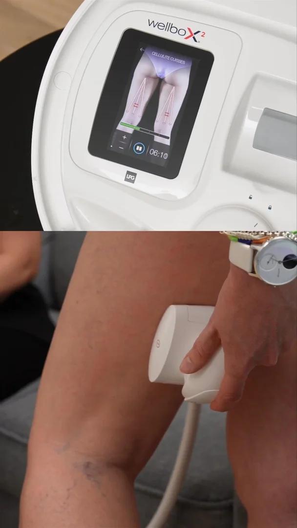 Wellbox® : 72 ventes en un live, le pari gagnant du live shopping beauté-tech 10